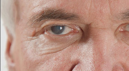 Design---Eye-Health-Page---Erker's_23
