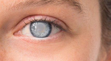 Design---Eye-Health-Page---Erker's_25
